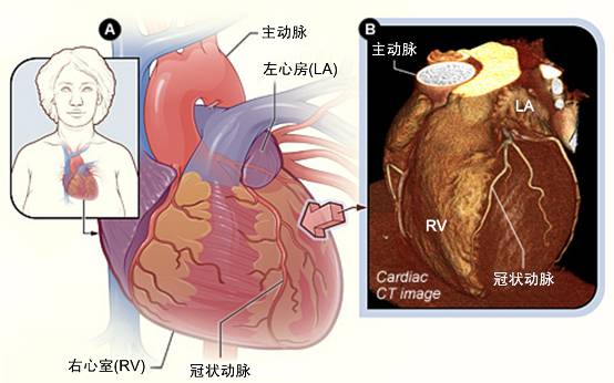 冠心病需要做哪些檢查？(圖2)